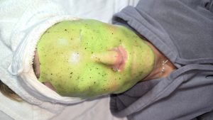 CBD Jelly Mask